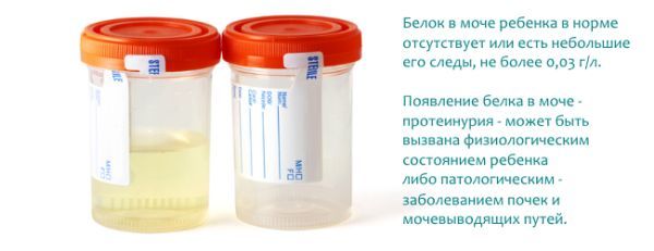 Суточная потеря белка с мочой при беременности