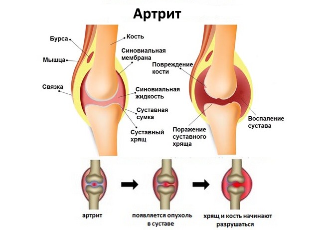 Фламидез