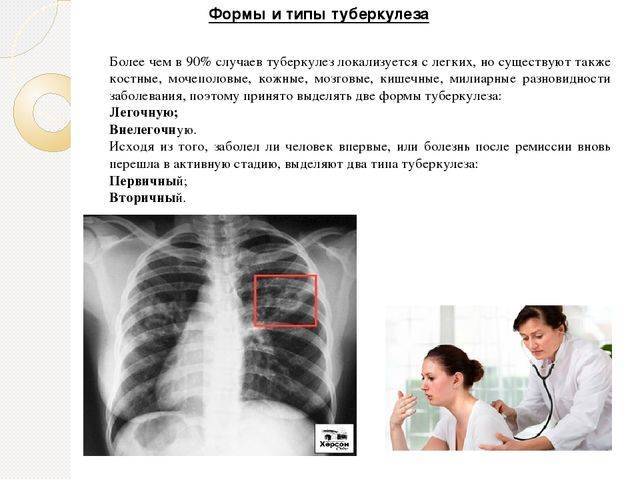 Симптомы, лечение и диагностика вторичного туберкулеза. что может спровоцировать заболевание?