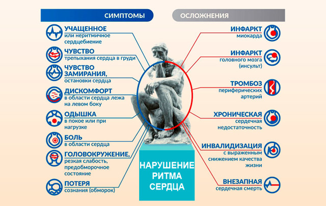 Аритмия сердца – все виды и причины нарушения сердечного ритма