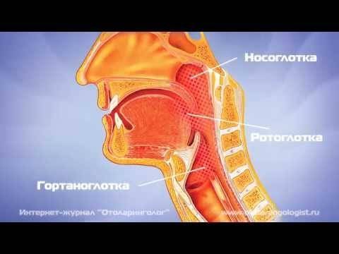 Хронический фарингит у взрослых