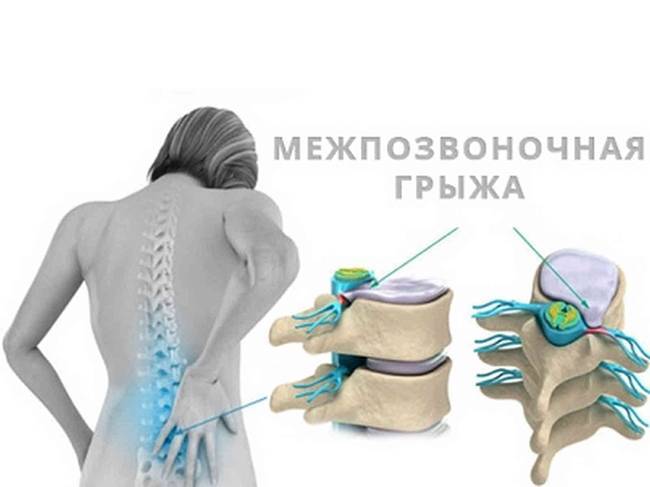 Кашель две недели и спина болит