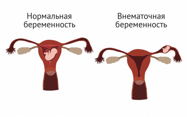 Почему болит левый бок под ребрами?