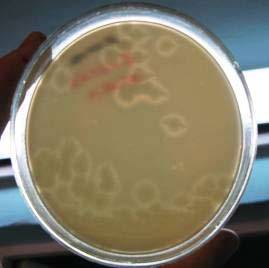 Bacillus cereus