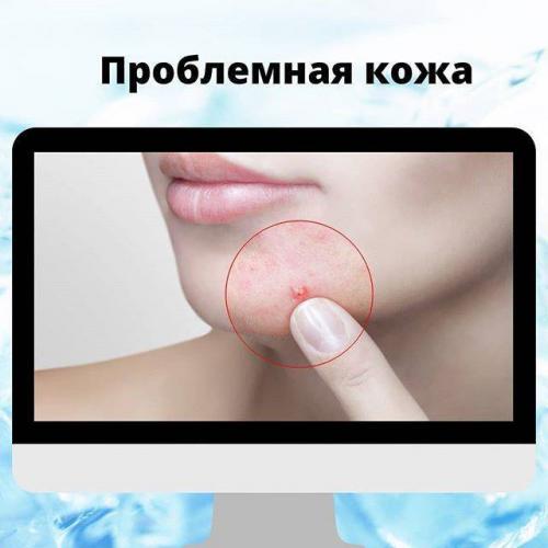 Malassezia грибок чем лечить