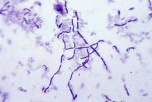 Идентификация бактерий bacillus cereus на основе их фенотипической характеристики
