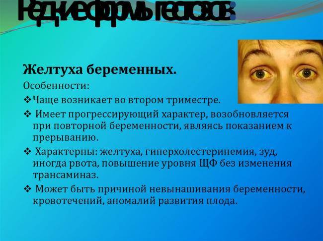 Гестоз