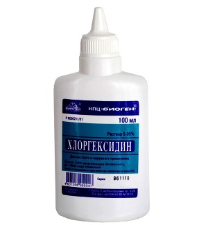 Киста зуба