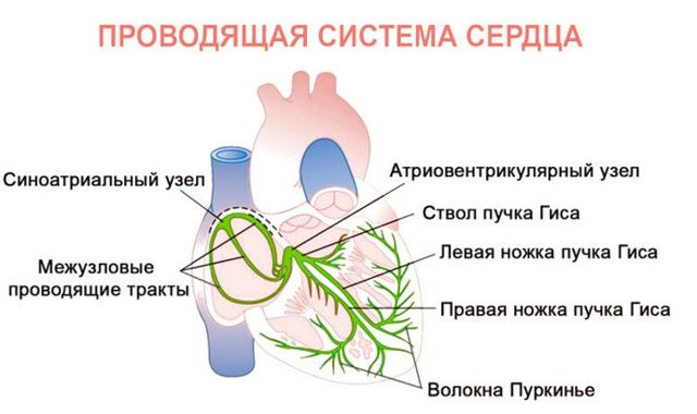 Блокада ножки пучка гиса