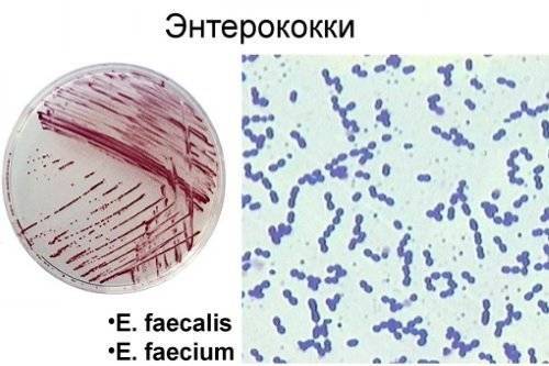 Enterococcus faecalis в мазке у женщин причины. из-за чего появляется enterococcus faecalis в мазке у мужчин
