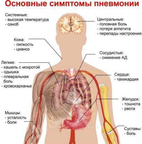 Симптомы воспаления легких у детей с температурой и кашлем