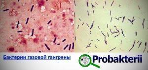 Бактериальные токсины их классификация и основные свойства