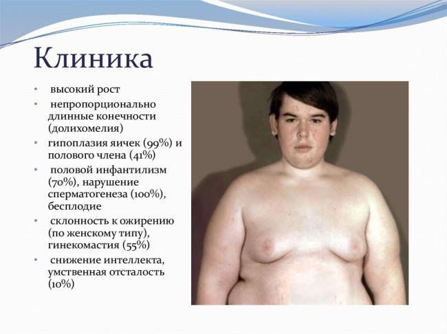 Инфантильные половые органы. недоразвитие половых органов (инфантилизм). половой инфантилизм: причины