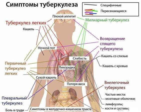 Первые признаки туберкулеза легких у женщин и мужчин