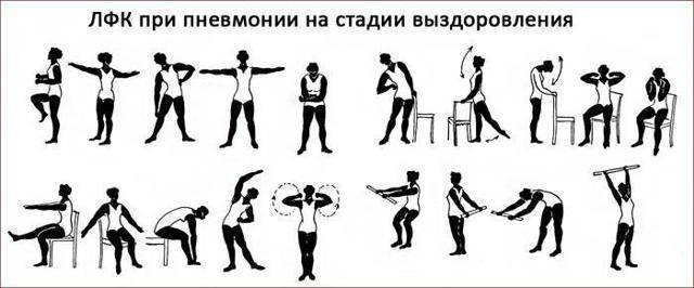 Дыхательная гимнастика при диагнозе «пневмония»