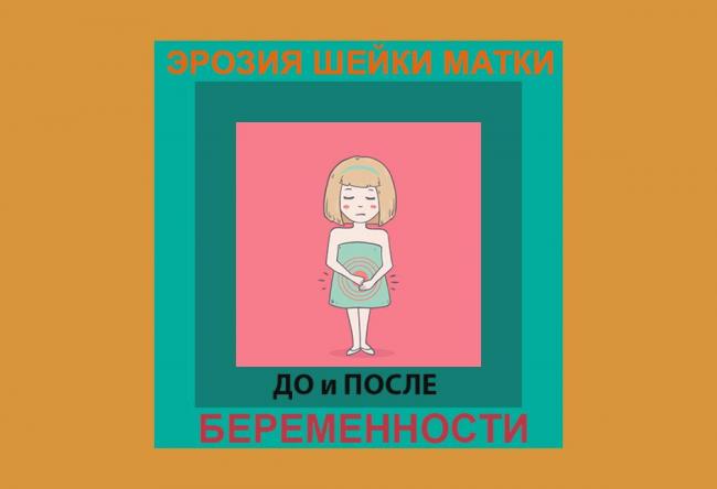 Цервицит или воспаление шейки матки — в чем опасность?