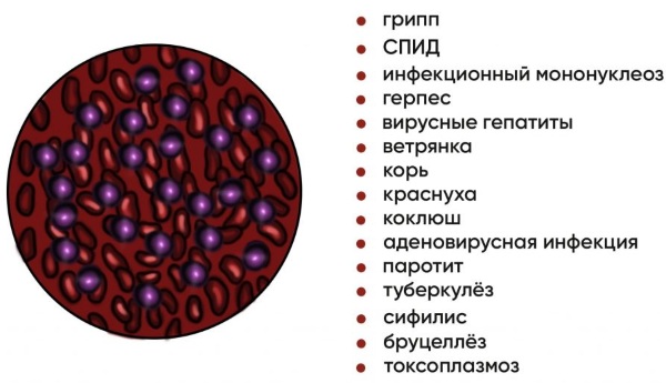 Лимфоцитоз