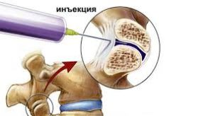 Ибупрофен: лечебный эффект и инструкция по использованию инъекций