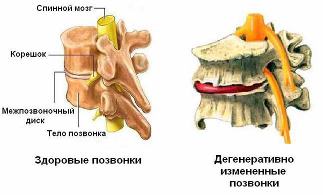 Эффективный хондропротектор дона порошок: инструкция по применению, цена, отзывы, аналоги препарата