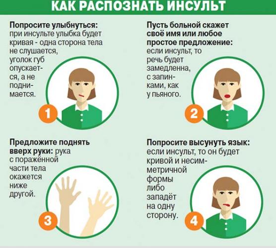 Каковы последствия инсульта у женщин в молодом и пожилом возрасте?