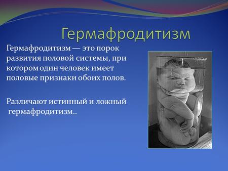 Адреногенитальный синдром – сольтеряющая, вирильная, постпубертатная форма у девочек, у мальчиков. диагностика, лечение адреногенитального синдрома