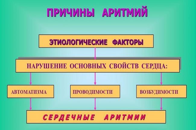 Что такое аритмия сердца? причины и лечение аритмии