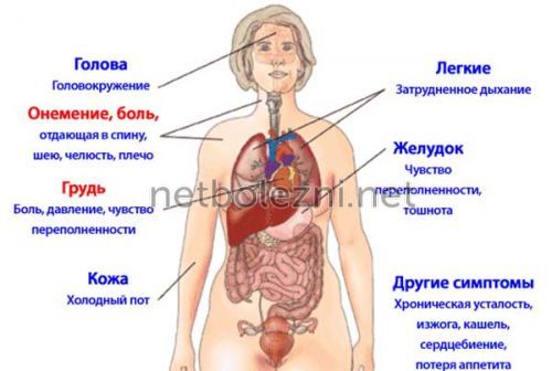 Прединфаркт симптомы первые признаки у женщин