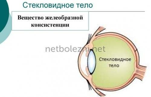 В глазу плавает черная паутина что это и как избавиться