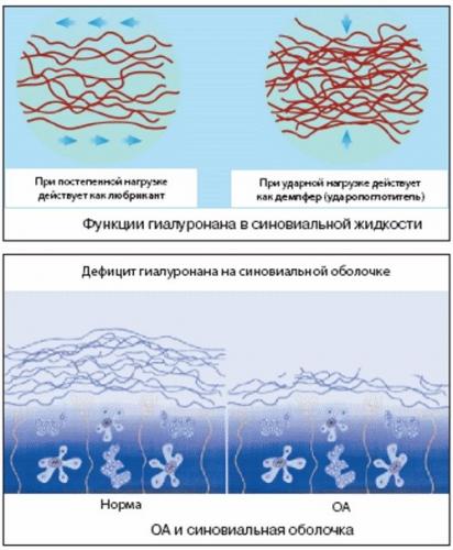 Артра: инструкция, аналоги, цены, отзывы