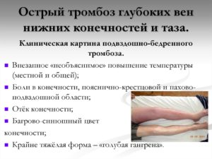 Тромбоз глубоких вен нижних конечностей лечение народными средствами