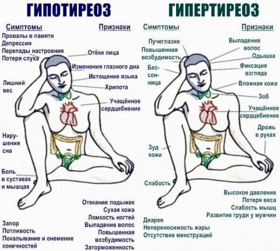 Аритмия сердца симптомы лечение первая помощь