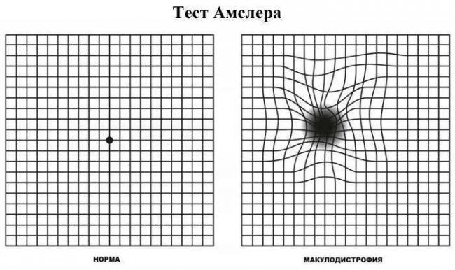 Изменение полей зрения