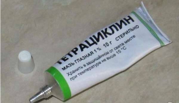 Какими средствами вылечить ожог глаза сваркой?