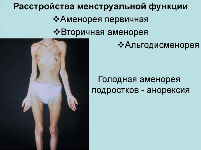 Половой инфантилизм (генитальный инфантилизм): причины, симптомы, лечение. генитальный инфантилизм признаки полового недоразвития