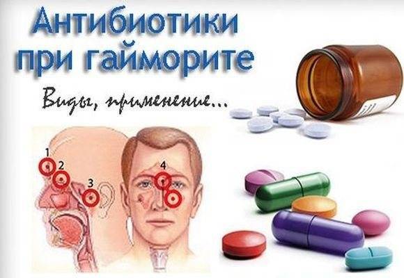 Какие антибиотики пить при гайморите - выбираем самые эффективные
