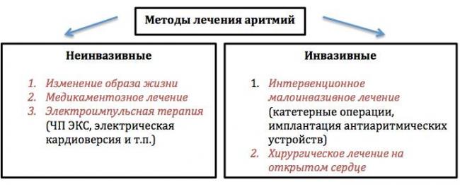 Аритмия