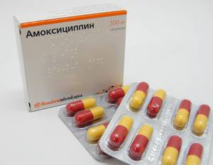 Какие антибиотики колоть при гайморите