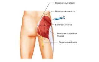 Артоксан инструкция по применению (уколы в ампулах)