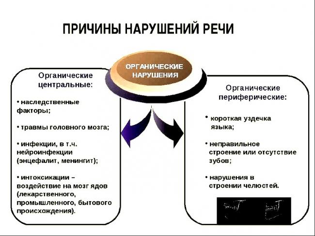 Виды речевых нарушений у детей