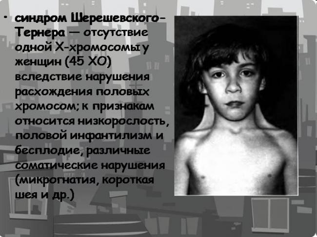 Генитальный инфантилизм по узи. генитальный инфантилизм, что это? причины, лечение. как проявляется недоразвитие половых органов