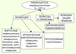 Лимфоцитоз: причины, формы, течение и проявления, диагностика, лечение