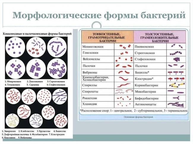 По каким признакам классифицируют бактерии