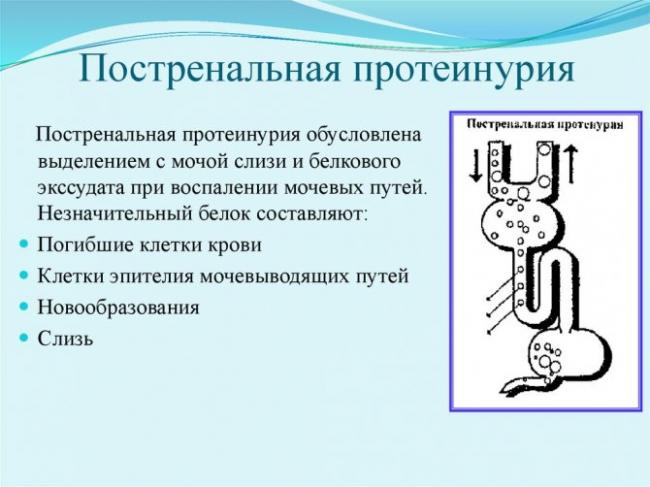 Белок мочи у беременных