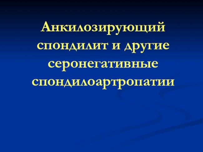Что собой представляет и характерные симптомы спондилита позвоночника