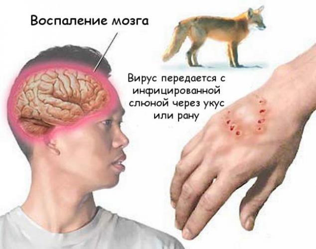Бешенство у человека. симптомы и лечение, инкубационный период, прививки