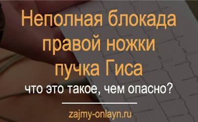 Неполная блокада правой ножки пучка гиса - как лечить?