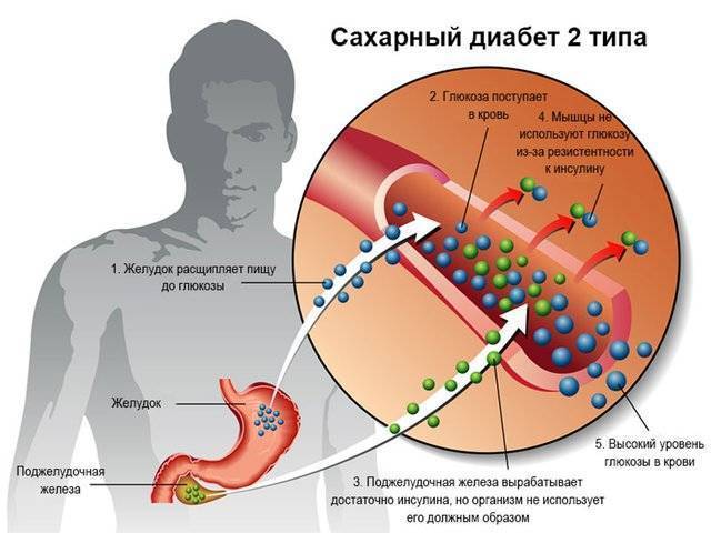 Тражента отзывы