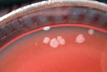 Bacillus thuringiensis характеристики, морфология, жизненный цикл / биология | thpanorama - сделайте себя лучше уже сегодня!