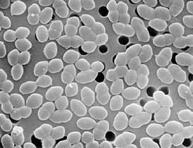 Enterococcus faecalis характеристика, морфология, патогенез