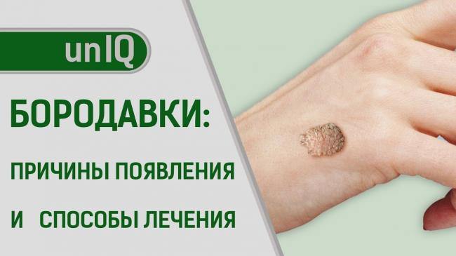 Вирусные бородавки — описание, свойства, причины, лечение и удаление бородавок (90 фото + видео)